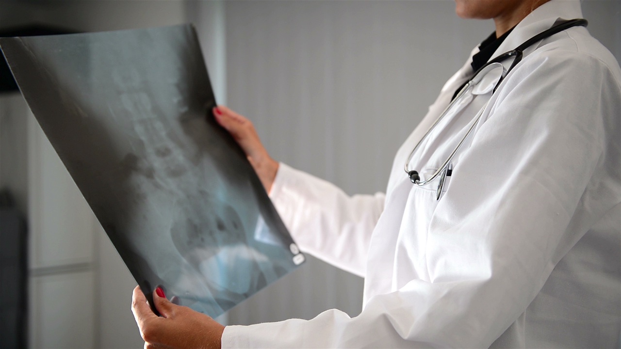X-Ray